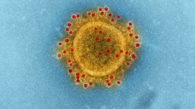 Nipah Virus Outbreak