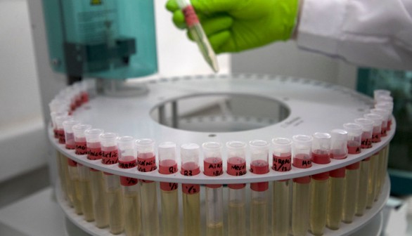 New Urine Analyis Method Could Detect Cancer, Other Diseases Early