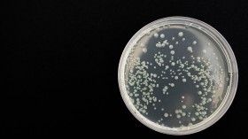 Bacteria, Sample, Petre Dish