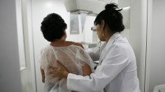 Mammogram