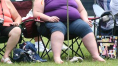 obese woman