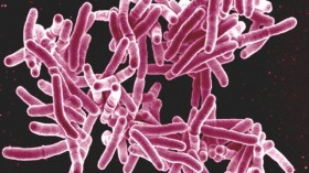 Tuberculosis