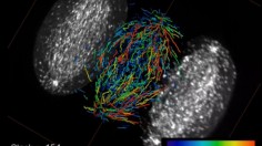 HeLa cell shown using lattice light sheet microscope