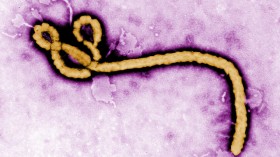 ebola