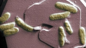 bacteria