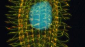 The genome sequence of the single-celled ciliate Tetrahymena thermophila