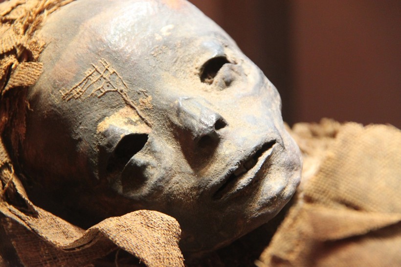Egyptian Mummy Found to House a Mummified Human Fetus  with a Rare Birth Defect