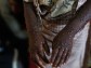 Monkeypox Evolution Reaches Deadly Strain, Now Detected in US